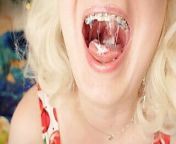 ASMR mukbang in braces - eating ice-cream from teeth braces girls tongue