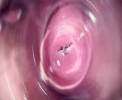 Inside Mia's vagina, internal camera in teen pussy from vagina inside camera