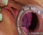 Blond junior nurse Kristyna inserts speculum in her pussy from juniors solo nude