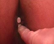 Cutouts: Treatment with laxative suppositories and enemas from doctors exam rectal anus girls spy camera