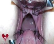 The mistress' cunt is opened with a hole expander so that you can study her cervix. from tapping her cervix
