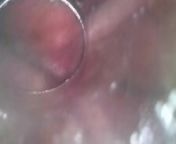 inside hot wet juicy pussy from inside vagina exam