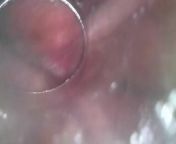inside hot wet juicy pussy from sex education camera inside of the vagina during sex